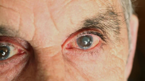 Aprueban en EE UU faricimab (Roche), que trata dos de las principales causas de pérdida de visión
