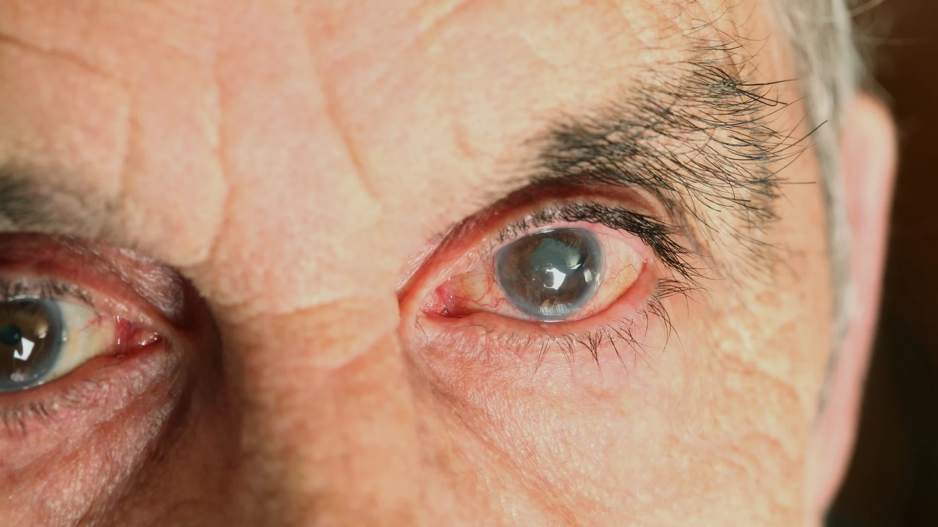 Aprueban en EE UU  faricimab (Roche), que trata dos de las principales causas de pérdida de visión