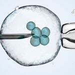 cell is holding by a pipet and a neeldle.