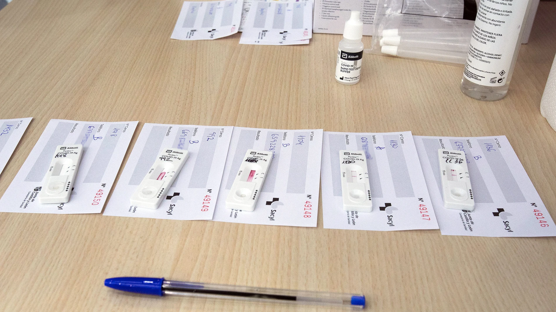 Los test de antígenos se están usando de forma masiva para conocer la situación epidemiológica en un territorio