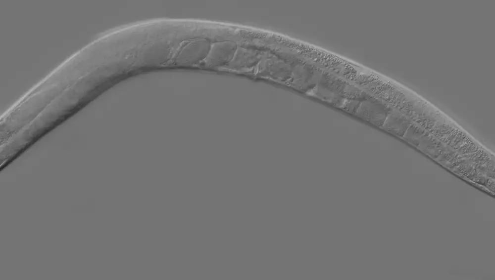 Imagen del Caenorhabditis elegans