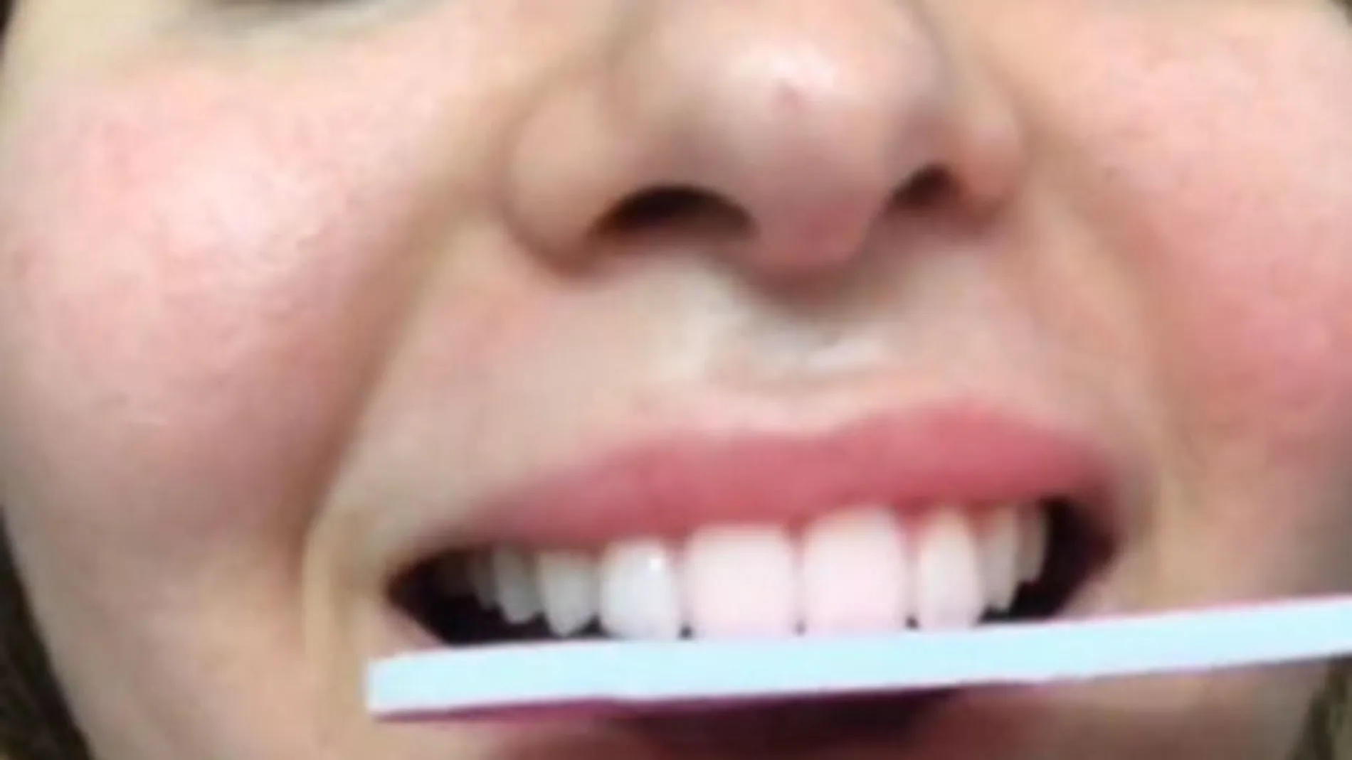Limarse los dientes en directo: así es el peligroso reto que se ha puesto de moda en TikTok