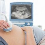 Según los doctores Jan Tesarik y Raquel Mendoza-Tesarik, la mejor opción, es asegurar la fertilidad antes de un posible contagio, criopreservando óvulos, espermatozoides o embriones.