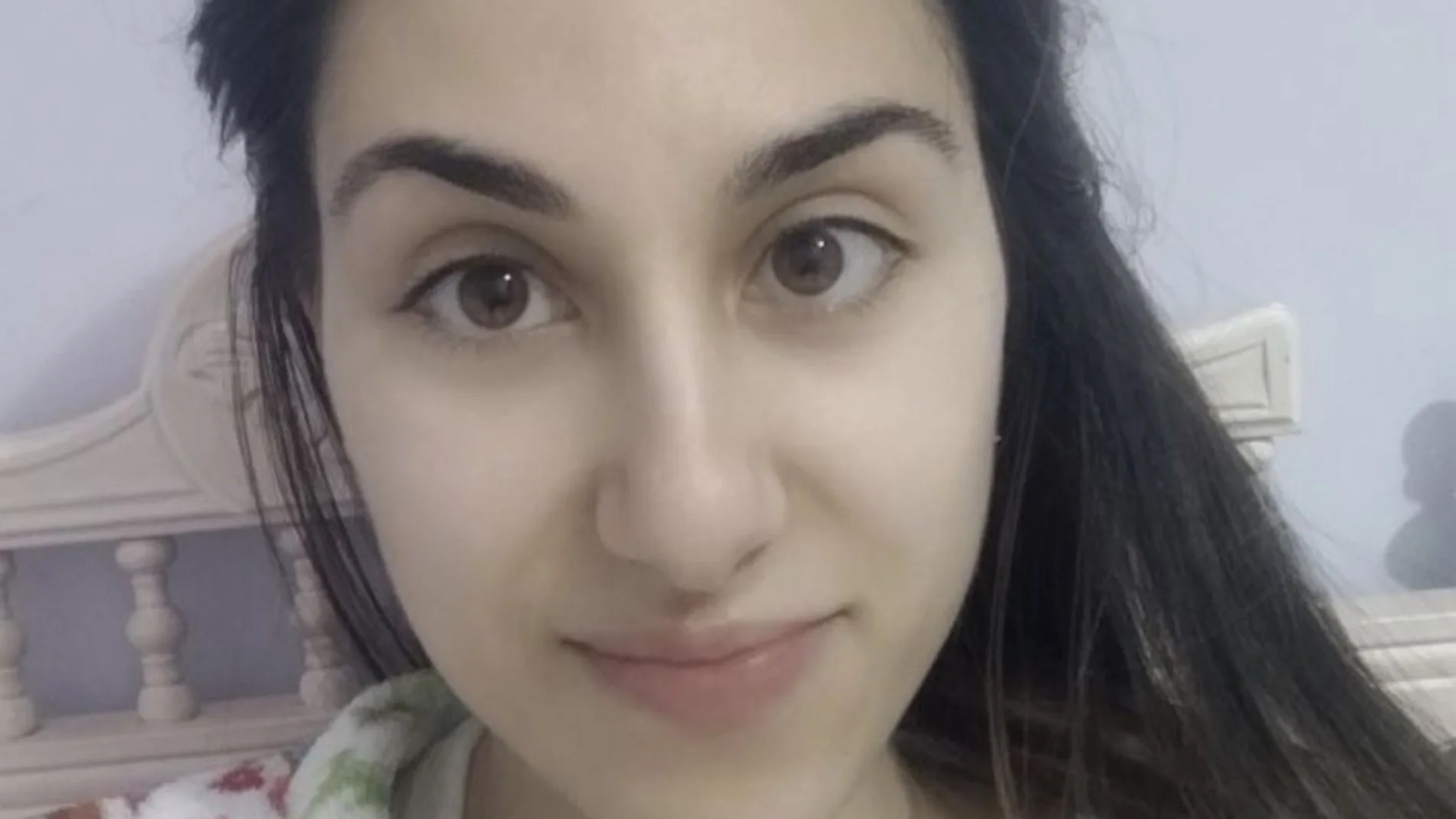 Miriam, de 24 años y cuyo padre es Guardia Civil, sufre el Síndrome de Wilkie, entre otros