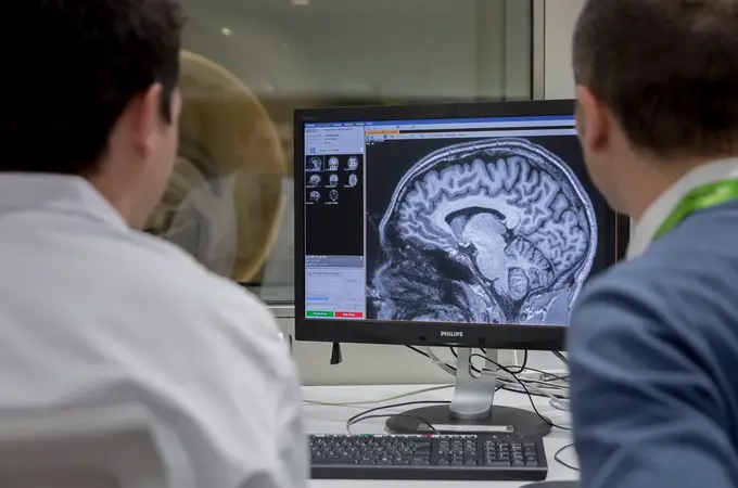 Cura contra el Alzheimer: los dos avances científicos que acercan el final de la enfermedad