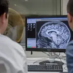 Los investigadores están cada día más cerca de lograr una cura para el Alzheimer