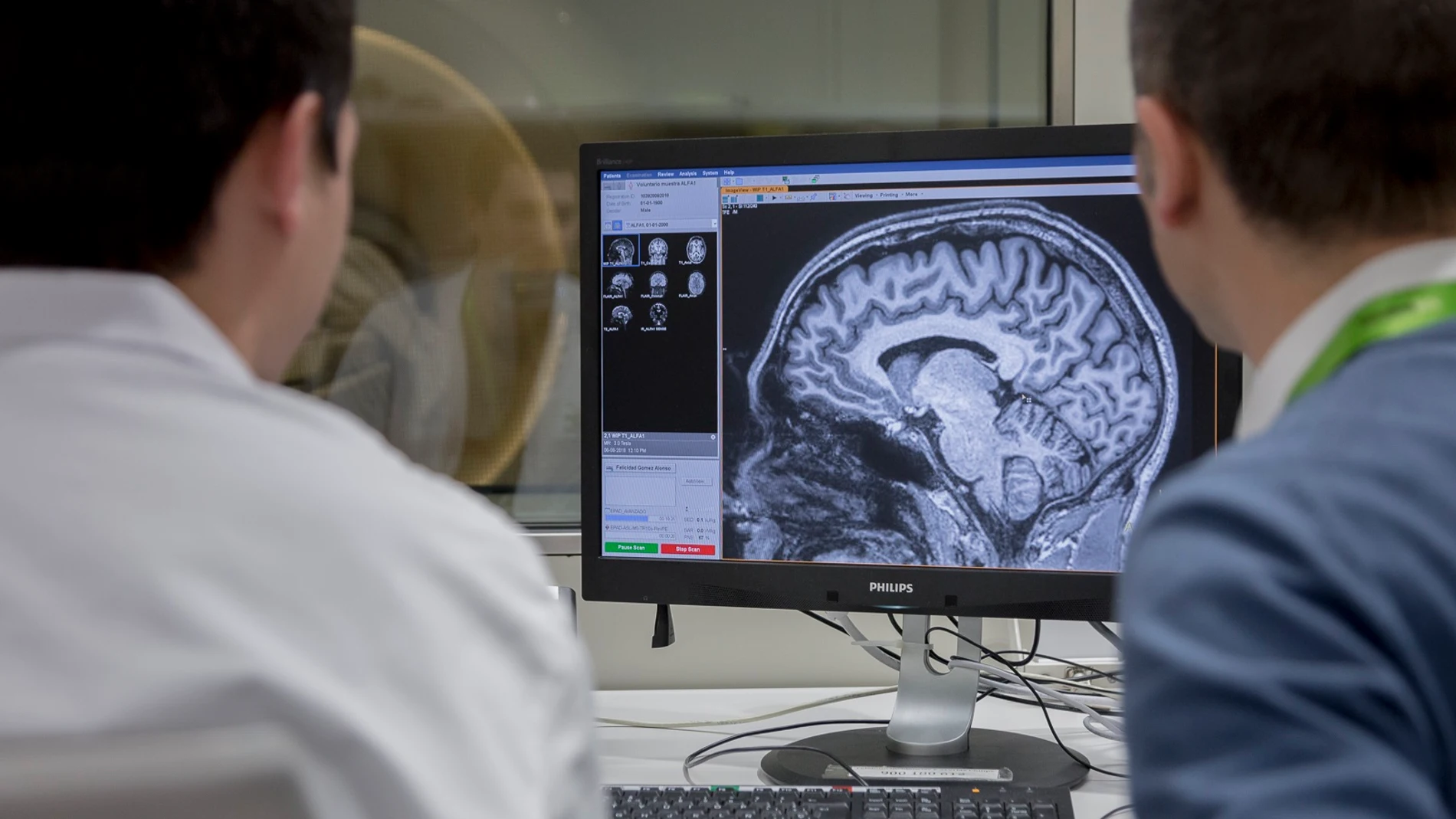 Los investigadores están cada día más cerca de lograr una cura para el Alzheimer