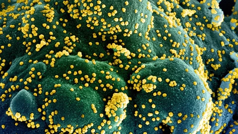 National Institutes of Health