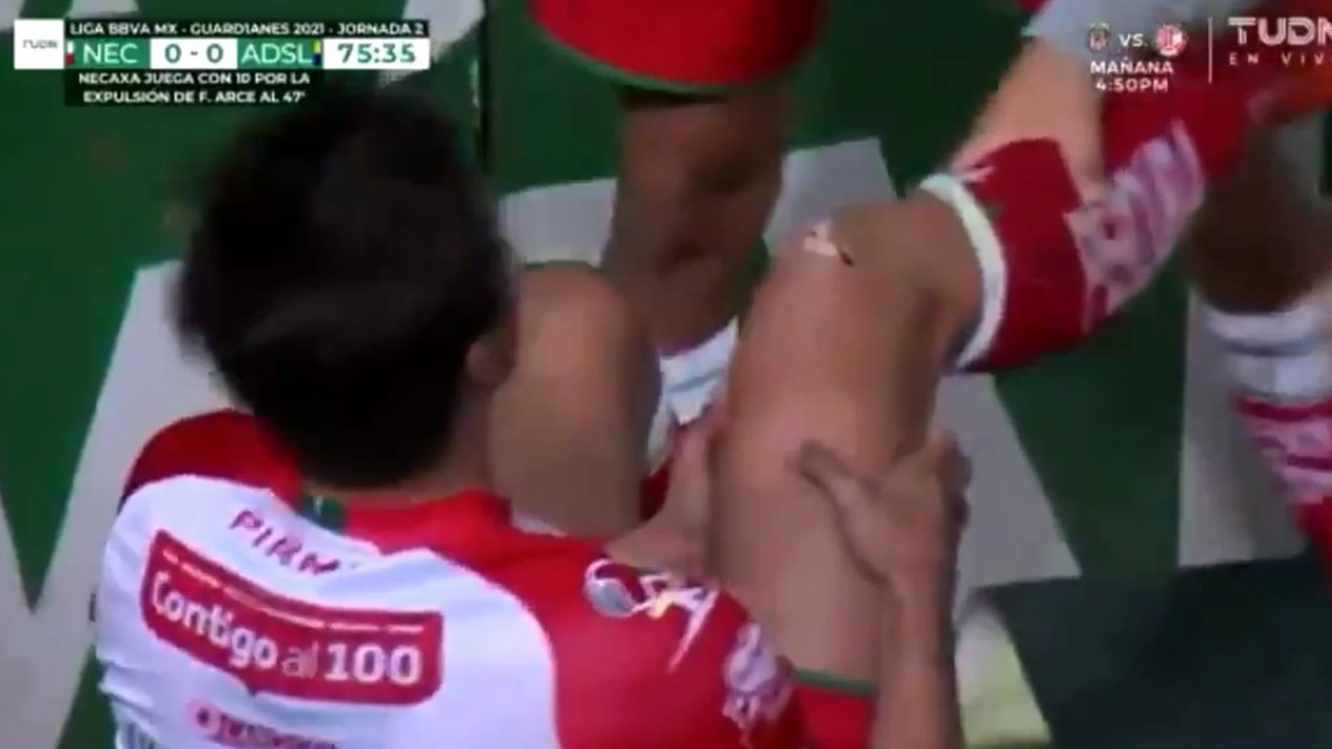 La dolorosa imagen de Unai Bilbao con un agujero en la rodilla hecho por un clavo