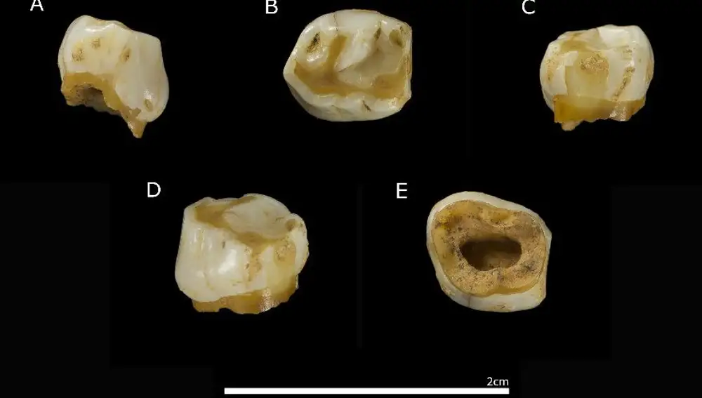 Diente de leche de una niña neandertal de unos ocho años descubierto en la campaña del 2019 y bautizado con el nombre de Vera, en la localidad de Cornejo en la Merindad burgalesa de Sotoscueva