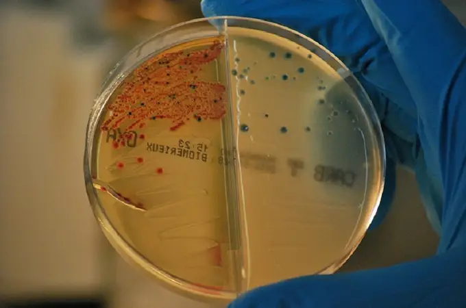 Nueva estrategia para frenar las resistencias bacterianas