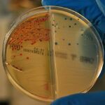 Bacterias resistentes a los antibióticos aisladas en el Intituto Ramón y Cajal de Investigación Sanitaria (IRYCIS)