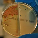  Glutamina, la llave contra las infecciones resistentes a los antibióticos