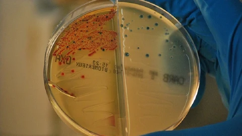 Bacterias resistentes a los antibióticos aisladas en el Intituto Ramón y Cajal de Investigación Sanitaria (IRYCIS)