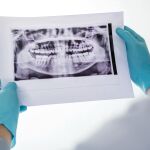 Diez dentistas españoles, entre los más prestigiosos del mundo