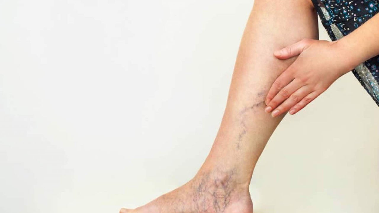Cuáles son los síntomas de la mala circulación en las piernas?