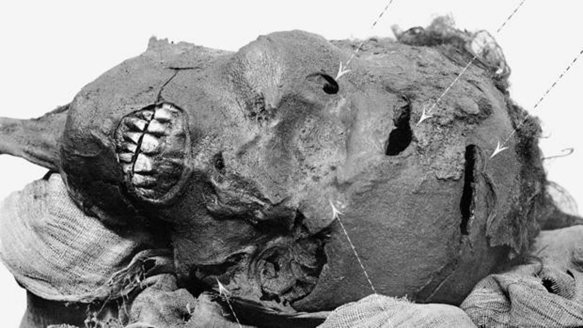 Fotografía de la momia, donde se perciben las heridas fatales de las que murió Seqenenra Taa
