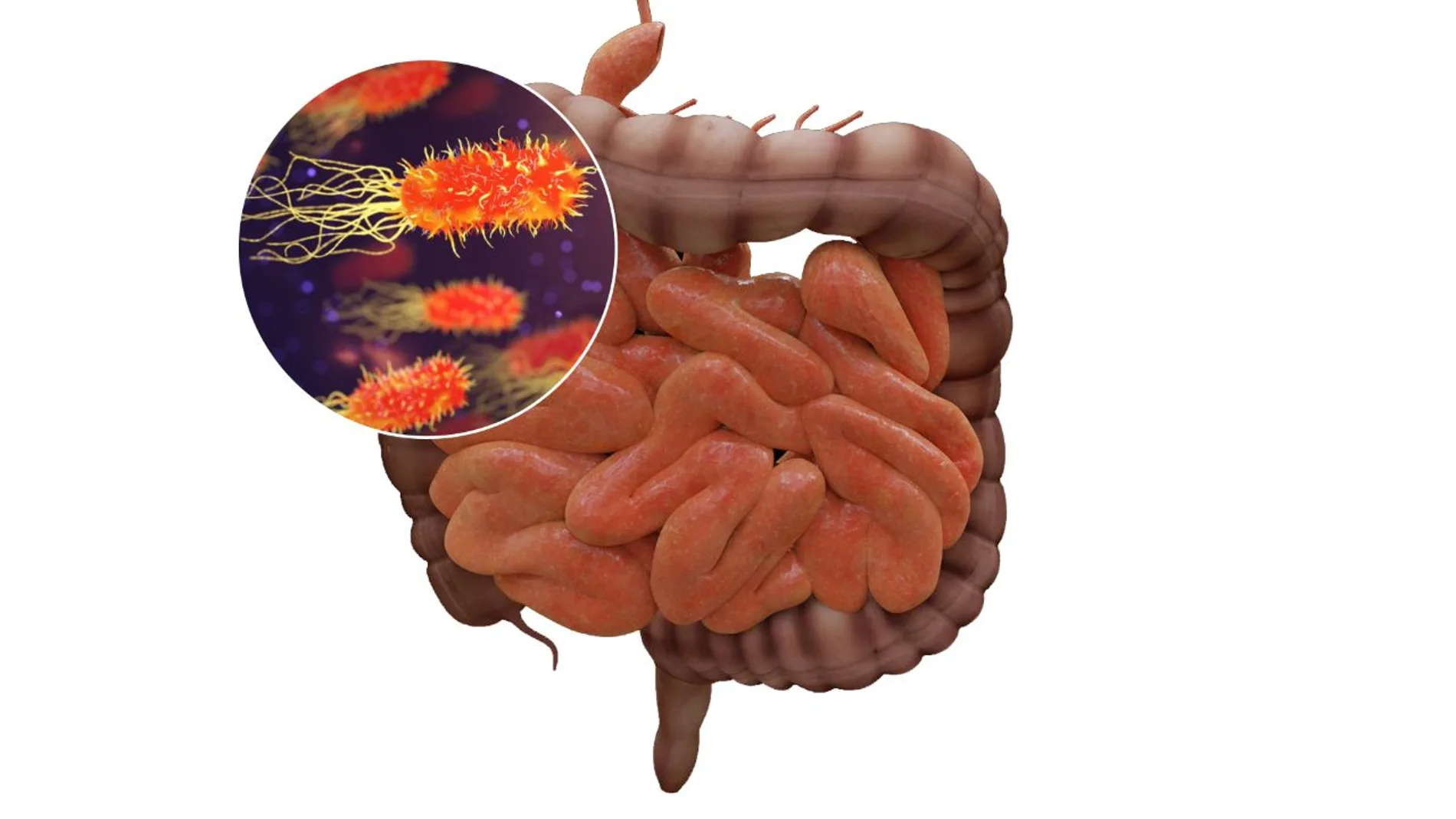 El microbioma intestinal puede influir en el riesgo de sufrir infecciones y en la respuesta defensiva frente a las mismas