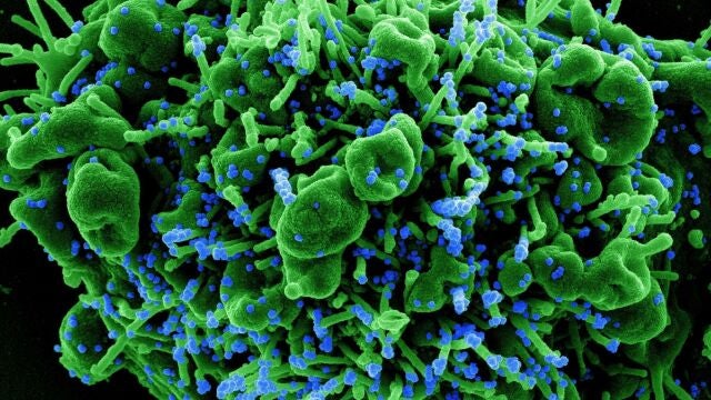 “Khosta-2″: encuentran en murciélagos rusos un virus similar a la Covid que puede infectar a los humanos y esquivar las vacunas