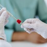 El SARS-CoV-2 sigue un patrón de diseminación diurno, que alcanza su pico máximo a las 14 horas, según una investigación.