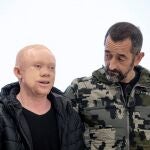 El cirujano Pedro Cavadas (d) ha presentado los detalles de la intervención de todos los cánceres múltiples de piel que ha logrado llevar a cabo en un paciente albino (i) procedente de Guinea Ecuatorial