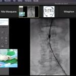 El Servicio de Cirugía Vascular de Santiago estrenó en marzo el centro de simulación clínica con un programa de entrenamiento avanzado en técnica endovascular
