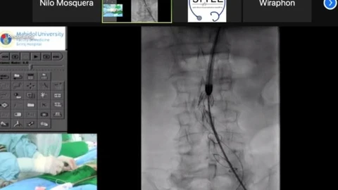 El Servicio de Cirugía Vascular de Santiago estrenó en marzo el centro de simulación clínica con un programa de entrenamiento avanzado en técnica endovascular