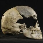 Visión lateral del cráneo (casi completo) de Zlatýk