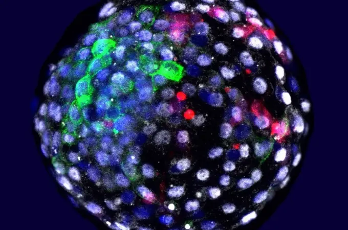 Científicos desarrollan los primeros embriones humanos sin óvulos ni esperma 