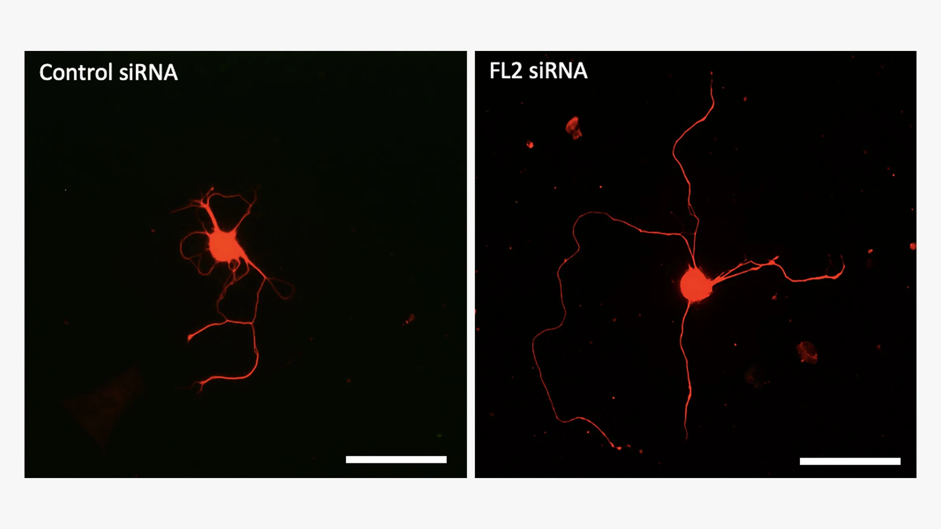 Estas imágenes muestran neuronas cultivadas en placas de Petri y tratadas con ARNip de control (inactivo) (izquierda) o con el propio ARNip (ARNip FL2) (derecha). Las neuronas tratadas con el fármaco regeneran sus axones (las fibras delgadas que se extienden desde los cuerpos centrales de las neuronas) a un ritmo significativamente más rápido que las neuronas tratadas con control