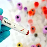  Eficacia de hasta el 80% de la vacuna antimalaria de Oxford 