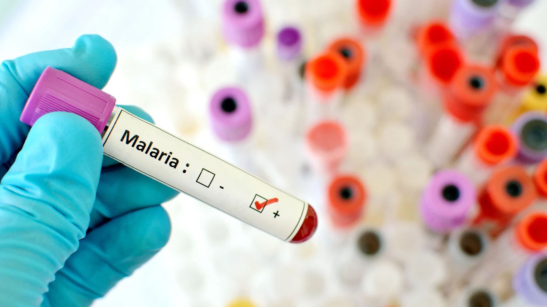 La investigación sobre la malaria ha dado un paso importante