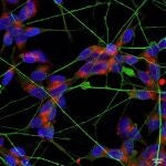 Un grupo de neuronas (azul) y las dendritas que las conectan (verde). El receptor ACE2 (en rojo) está presente en el cuerpo principal neuronal.