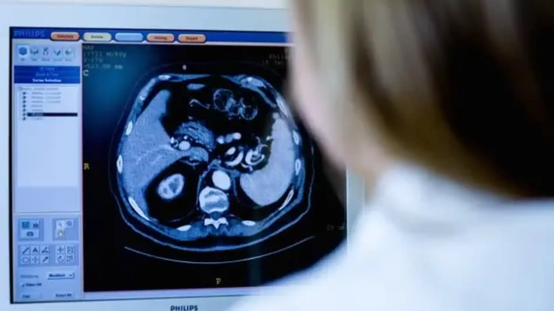 El webinar, abierto al público y en formato online, está avalado por la Sociedad de Medicina Nuclear e Imagen Molecular de Valencia