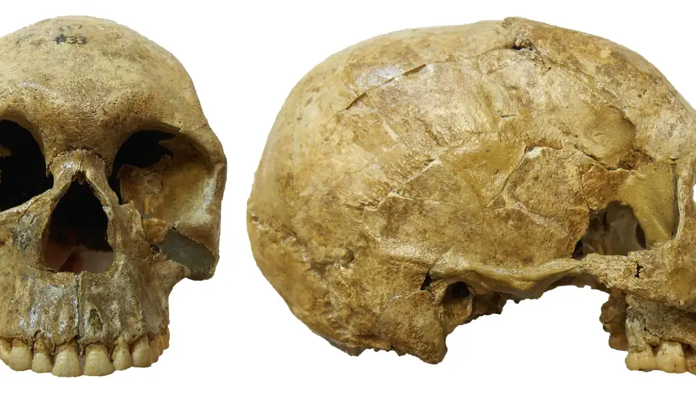 Vista anterior y lateral derecha de un cráneo, encontrado en Sudán