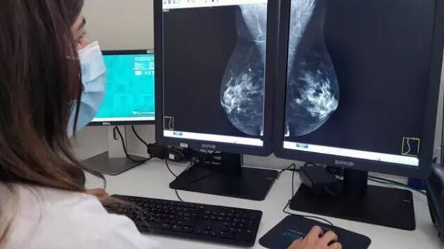 Quirónsalud Marbella incorpora un mamógrafo 3D para el diagnóstico precoz de patología mamaria