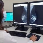 Quirónsalud Marbella incorpora un mamógrafo 3D para el diagnóstico precoz de patología mamaria