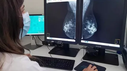 Quirónsalud Marbella incorpora un mamógrafo 3D para el diagnóstico precoz de patología mamaria