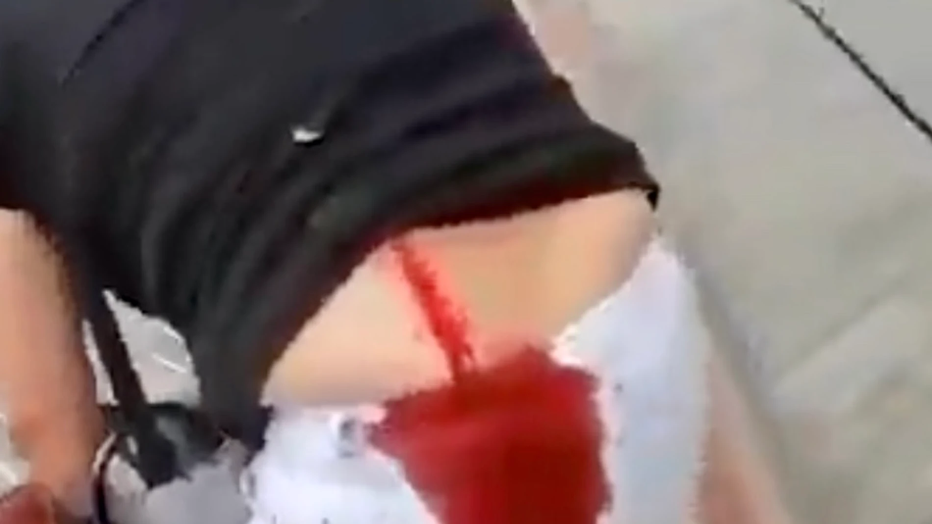 Una mujer es apuñalada por la espalda en las colas del hambre al grito de "nos robais la comida"