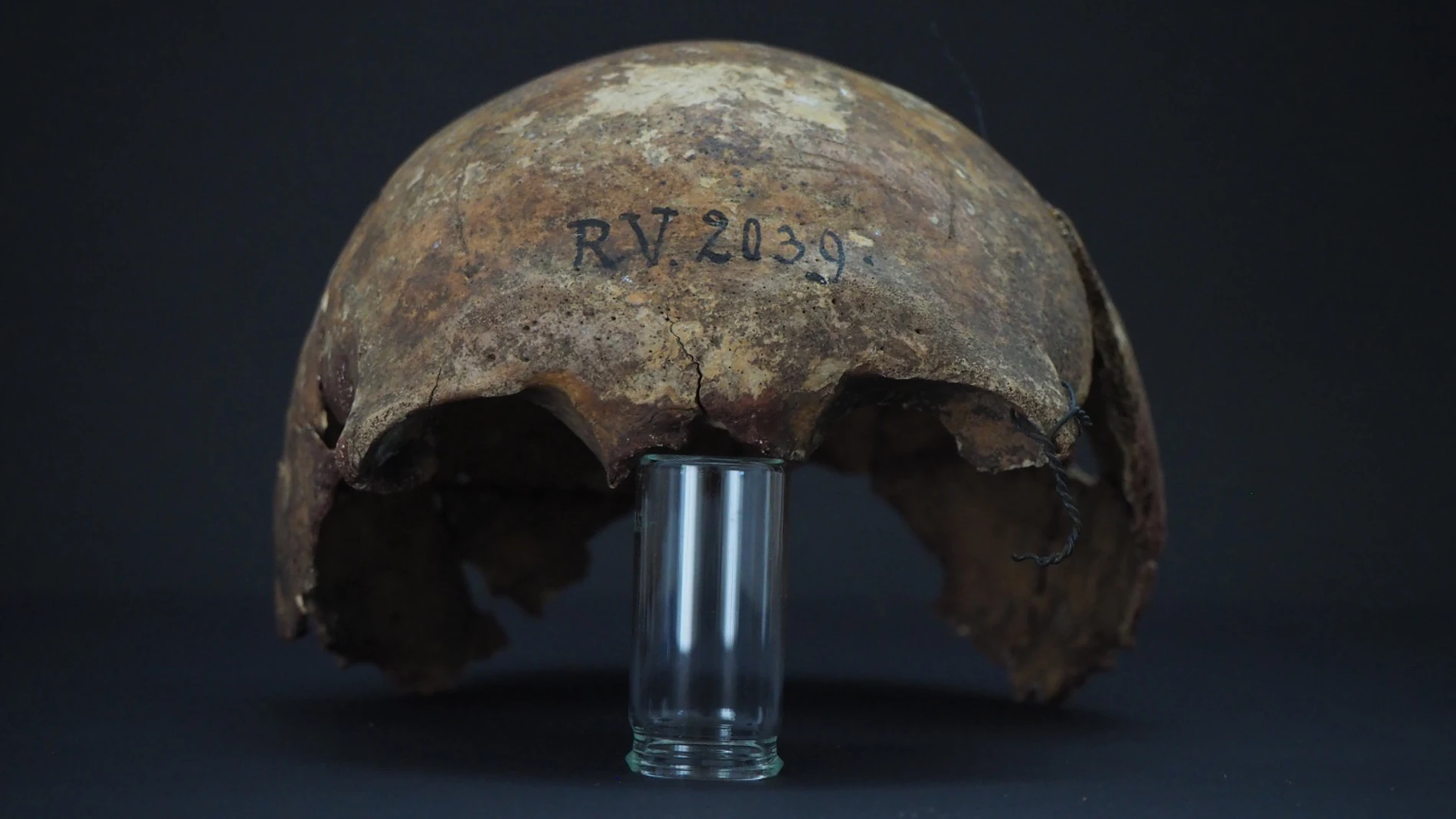 Cráneo del cadáver hallado en Letonia