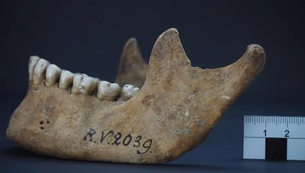 Mandíbula del cadáver hallado en Letonia, de hace 5.000 años