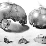 Dibujos del cráneo de Engis 2 encontrado en 1829