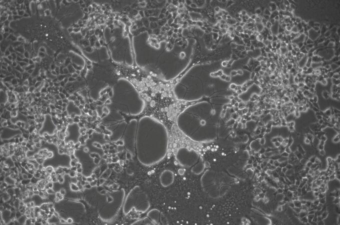 Célula infectada con una variante del Virus del Herpes Simplex generada durante el cultivo celular.