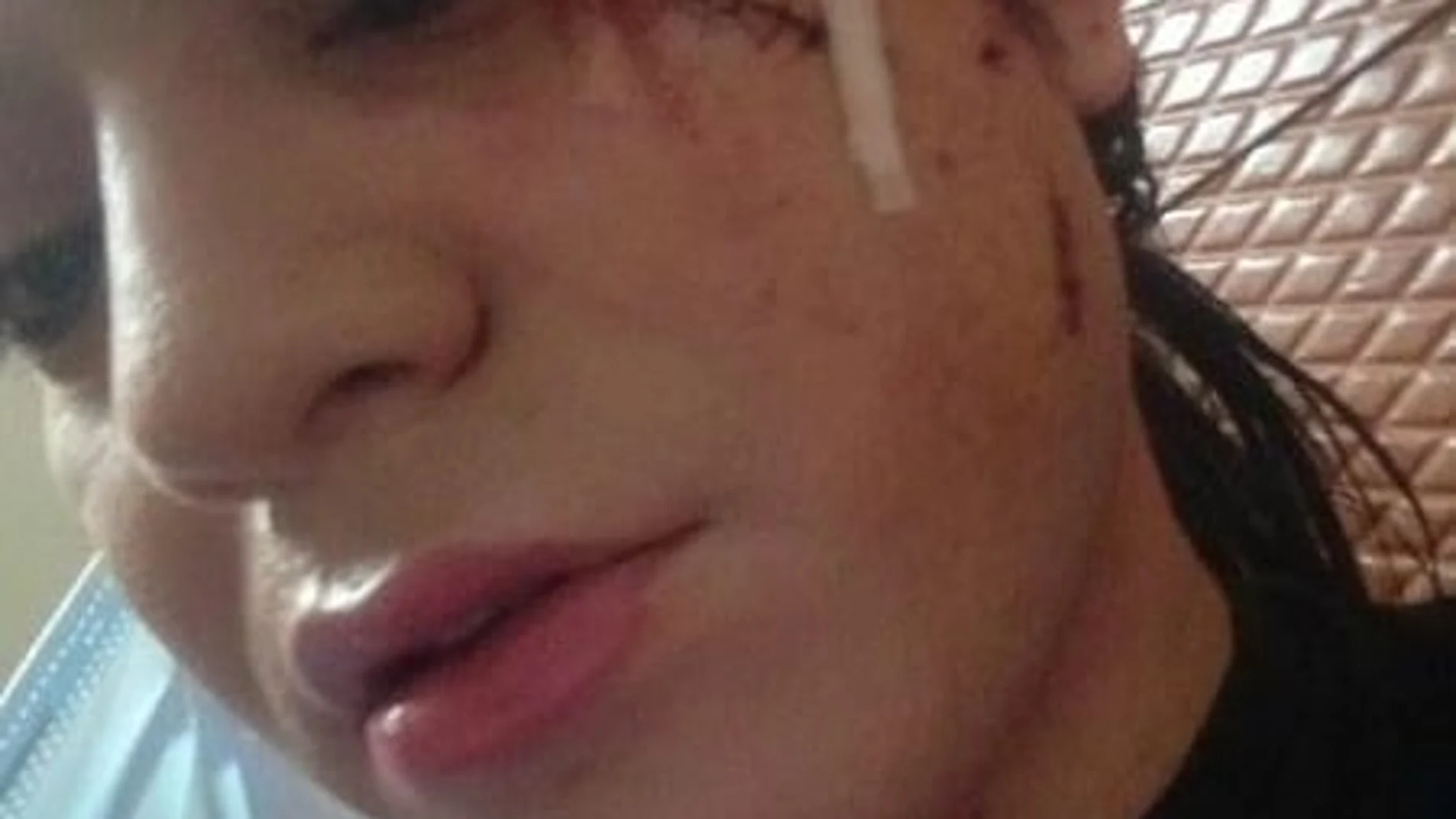 Una chica transexual de Palencia denuncia una agresión