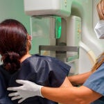 La compresión mamaria es uno de los factores que más ansiedad genera a las mujeres que participan en el programa de cribaje de cáncer de mama