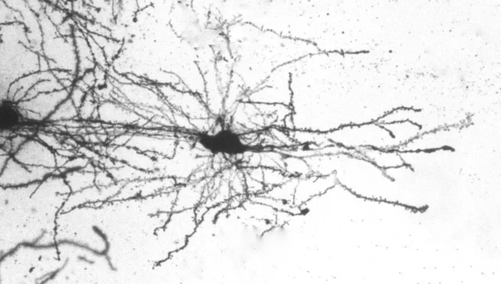 "Cajal vive, la lucha sigue" fue la foto más votada en Twitter en el I Concurso de Fotografía científica del Instituto de Neurociencias UMH-CSIC