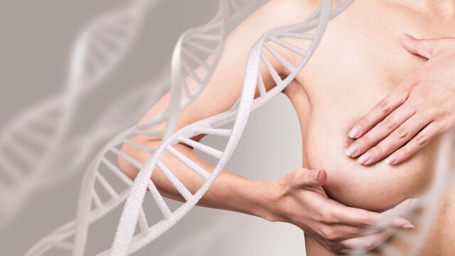 Aumentar la actividad física reduce el riesgo de cáncer de mama