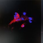 El equipo de microbiólogos de la Universidad de Hong Kong ha logrado aislar la variante Omicron Covid-19 de muestras clínicas