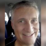 El dentista Guido Russo de 57 años que se puso un brazo de silicona para evitar la vacuna