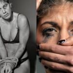 Las imágenes publicadas por Liliana Szilágyi tratan de demostrar el dolor sufrido durante estos años